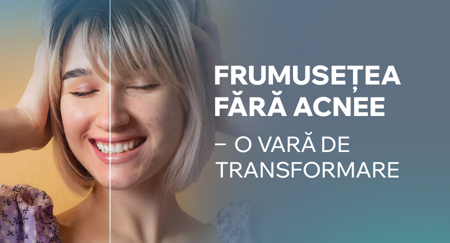 Farmacia Familiei dă startul campaniei “Frumusețea fără acnee - o vară de transformare”