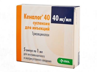 Kenalog 40mg/ml