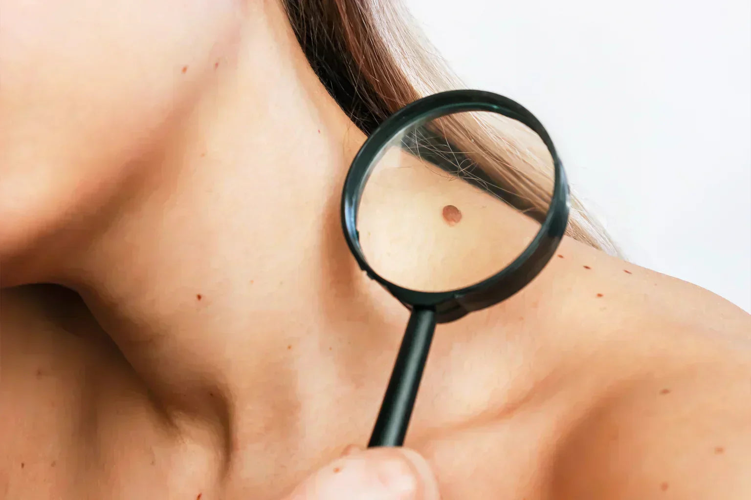 2026: Cancerul de piele poate fi prevenit! Fii în siguranță la soare! Testează-te gratuit!