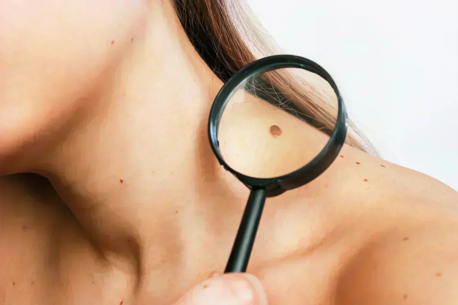 2026: Cancerul de piele poate fi prevenit! Fii în siguranță la soare! Testează-te gratuit!