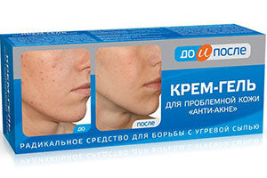Do i posle Crema antiacne 50ml